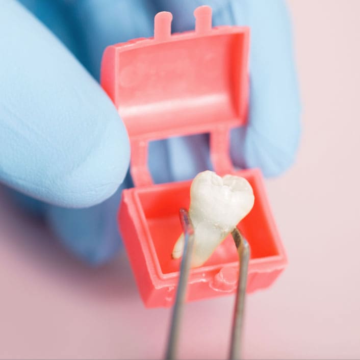 tooth extractions in Frisco