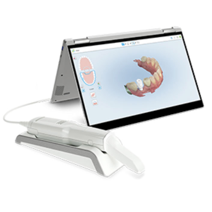 iTero scanner - dental tools at Renew Family Dentistry in Frisco