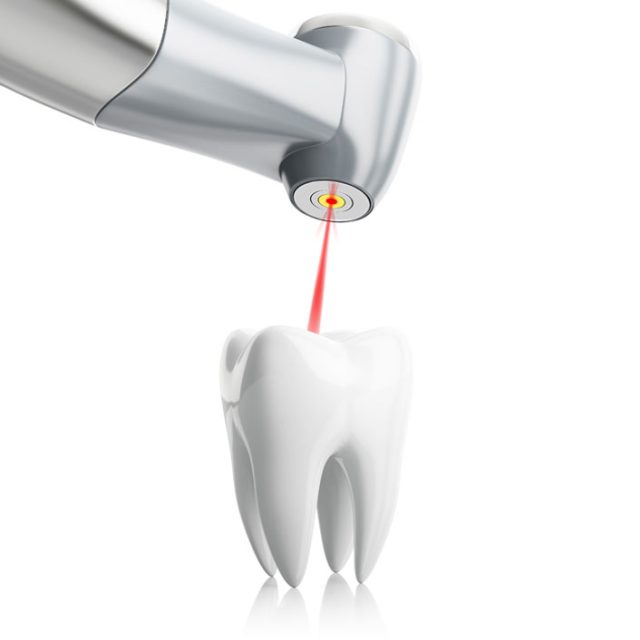 Laser dentistry at Renew Family Dentistry in Frisco