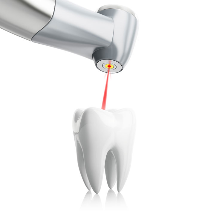 Laser dentistry at Renew Family Dentistry in Frisco