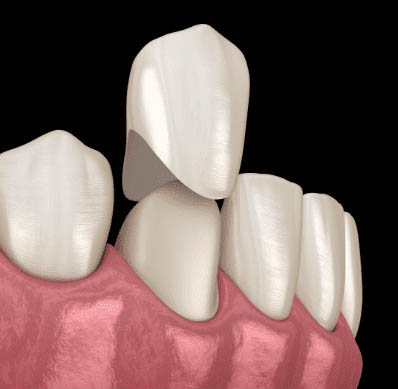 dental services in Frisco