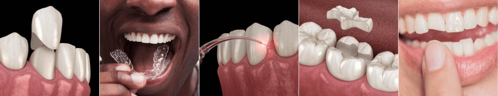 dental services at Renew Family Dentistry in Frisco