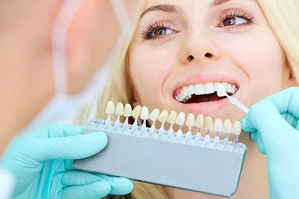 porcelain veeer shade options at Renew Family Dentistry